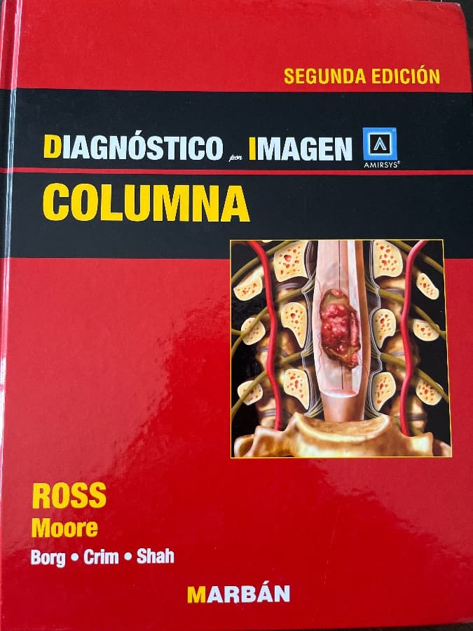 Diagnóstico por Imagen: Columna (Segunda Edición) — Ross, Moore, Borg, Crim, Shah, libro usado (foto 1 de 5)