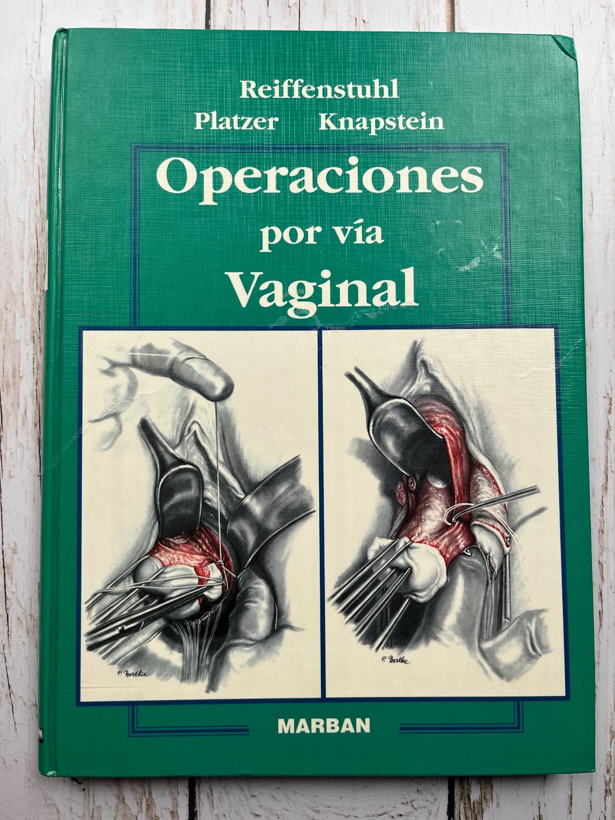 Operaciones por vía vaginal
