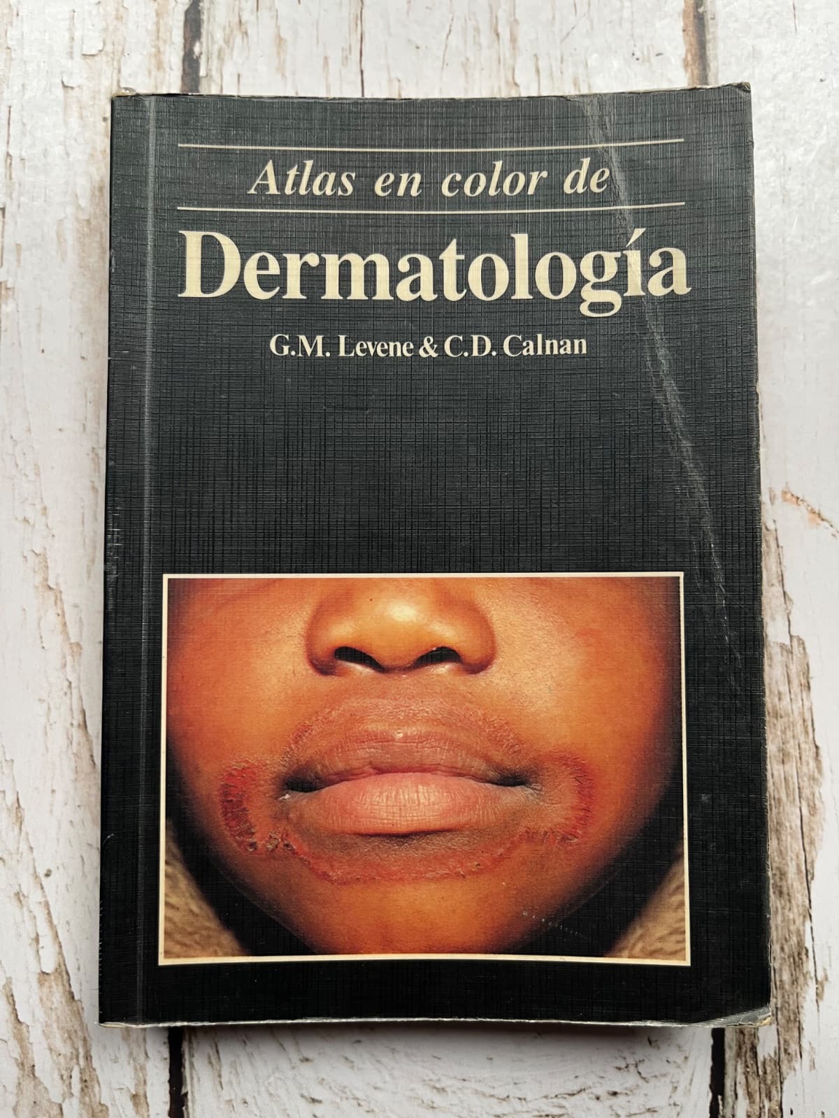 Atlas en color de Dermatología — G. M. Levene & C. D. Calnan, libro usado